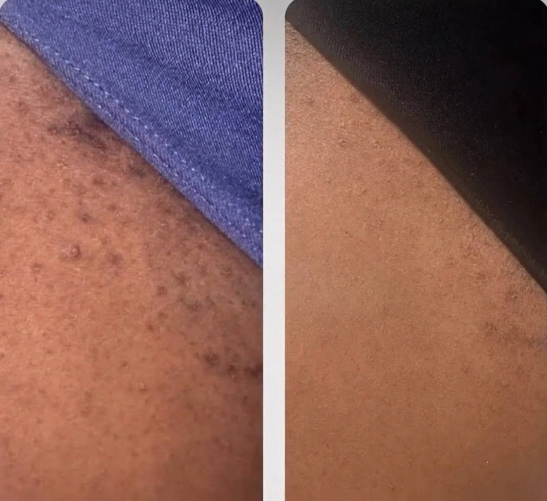 Comparison image